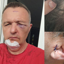 Chuligański napad na festynie. Poszkodowani prezes KGW, radny i sołtys